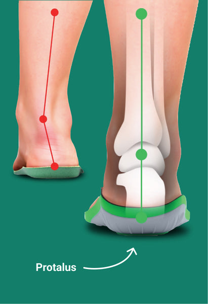 Protalus Insoles